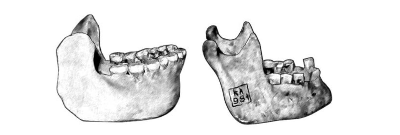 Слева&nbsp;— нижняя челюсть неандертальца. Обратите внимание на&nbsp;«ретромолярное пространство»&nbsp;— промежуток между&nbsp;третьим коренным зубоми восходящей ветвью челюсти. Справа&nbsp;— нижняя челюсть современного человека