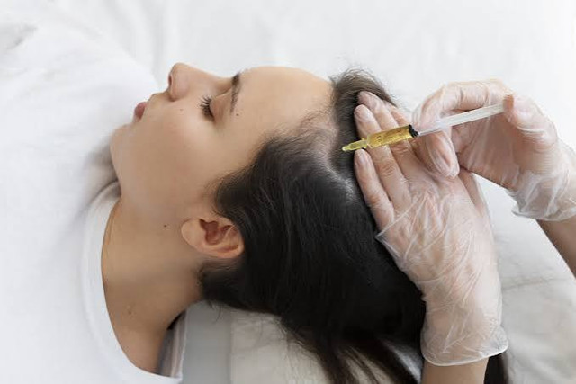 RF Microneedling Janakpuri for Healthy Skin Texture in myraluxxe.com