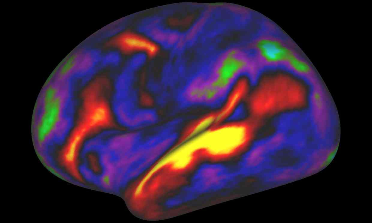 The pattern of brain activation (red, yellow) and deactivation (blue, green) in the brain’s left hemisphere when listening to stories while in an MRI scanner. Photograph: Matthew F. Glasser, David C. Van Essen [1]