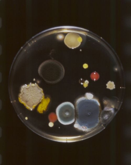 Колонии микроорганизмов, которые использовал Мартин Маржела для одной из&nbsp;своих коллекции «9/4/1615»