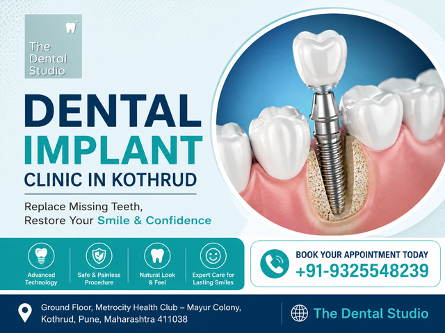 Dental Implant Clinic in Kothrud