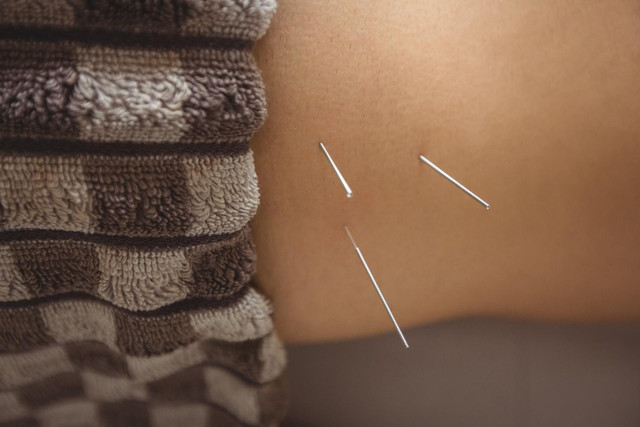 IVF Acupuncture San Francisco CA for Supportive Fertility Wellness