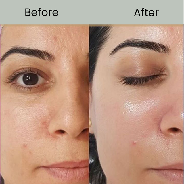 How to Compare Whitening Injection Prices Without Buying a Fake