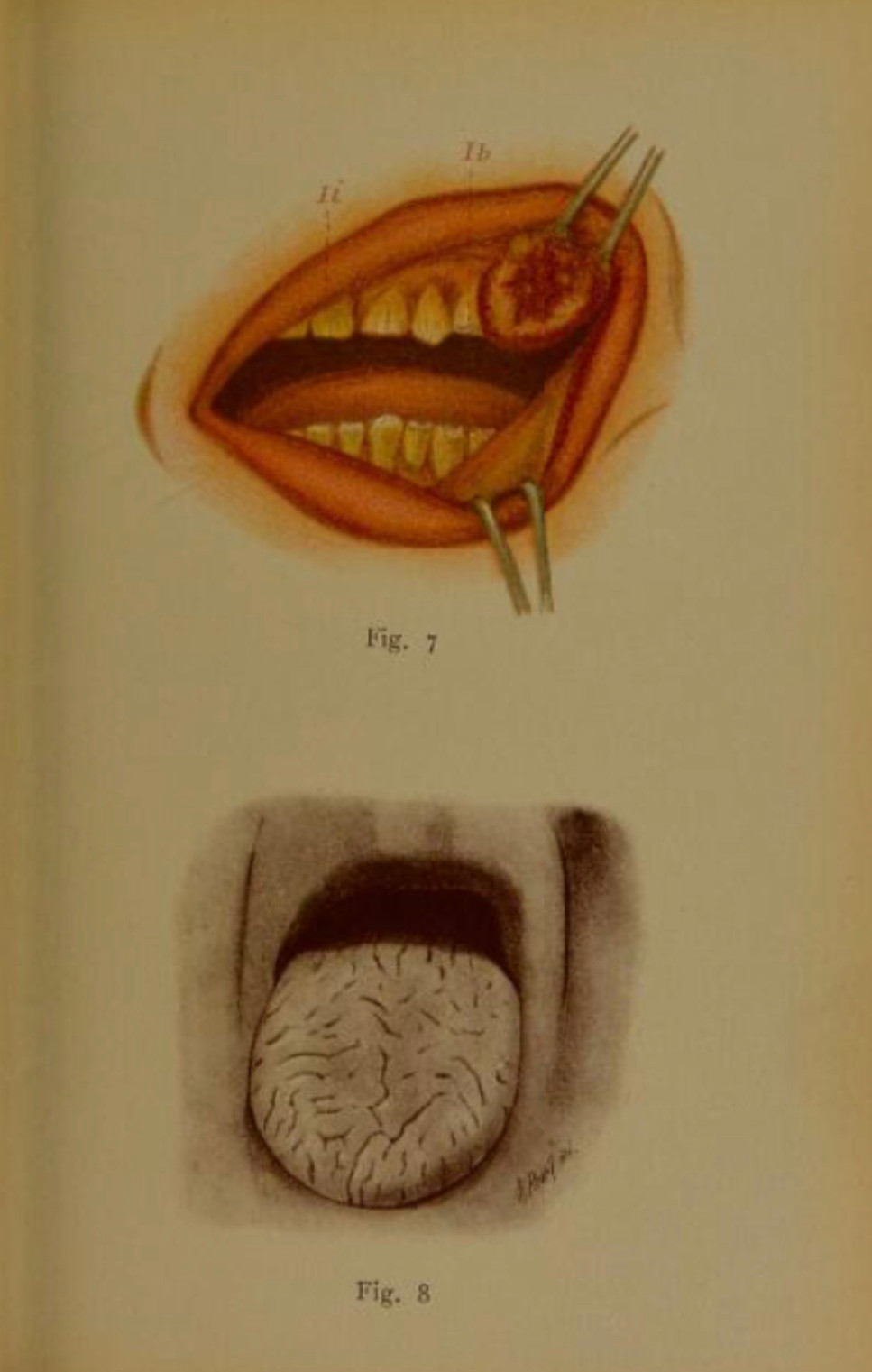 Эта иллюстрация приводится Акерманом, как&nbsp;послужившая источником к&nbsp;Бэконовской картине «Три этюда к&nbsp;фигурам у&nbsp;подножия распятия»