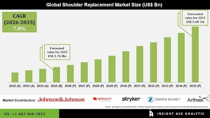 Shoulder Replacement Implants Market Growth Analysis, Dynamics, Key Players and Innovations, Outlook and Forecast 2026-2034