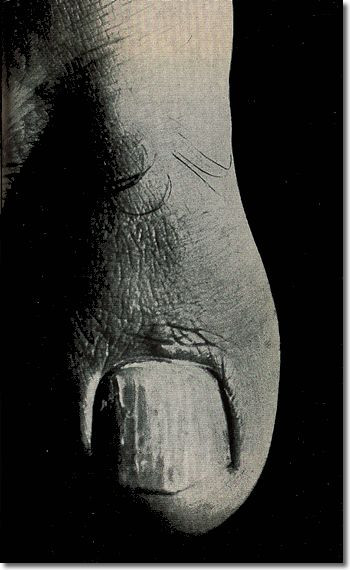 Jacques-André Boiffard «Big Toe, masculine subject, thirty years old, Documents, No6», 1929, Centre Georges-Pompidou (большой палец ноги тридцатилетнего мужчины)