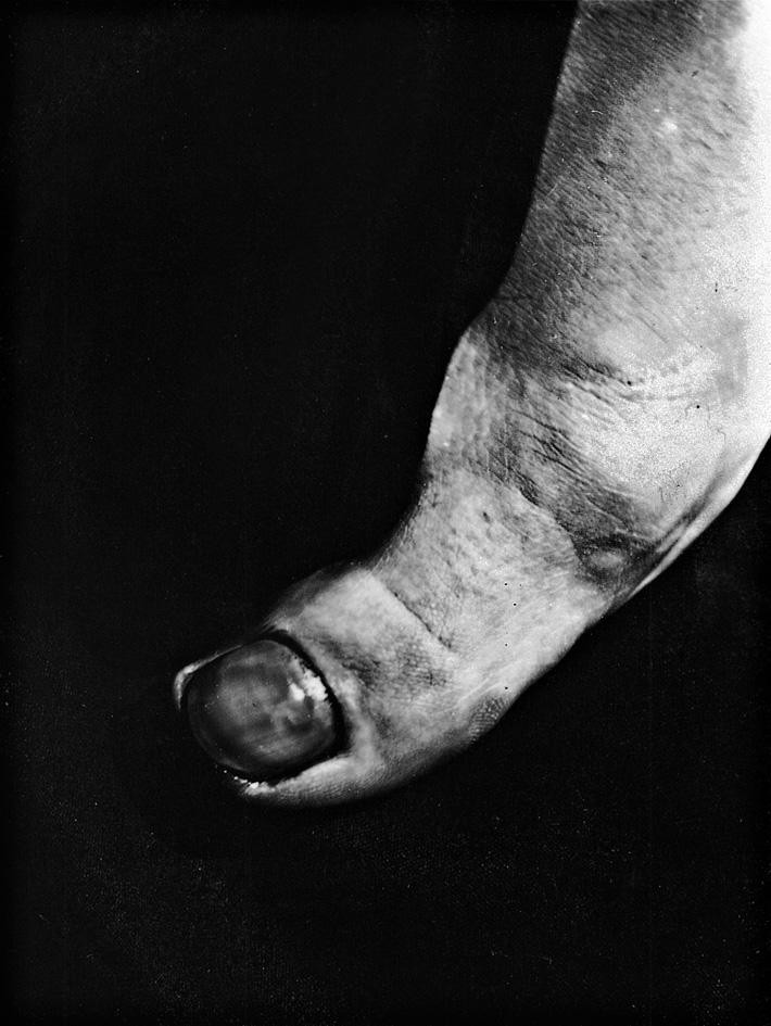 Jacques-André Boiffard «Big Toe, feminine subject, twenty-four years old , Documents, No6», 1929, Centre Georges-Pompidou (большой палец ноги двадцатичетырехлетней женщины)