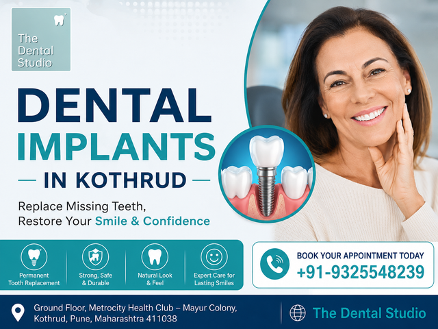 Dental Implants in Kothrud