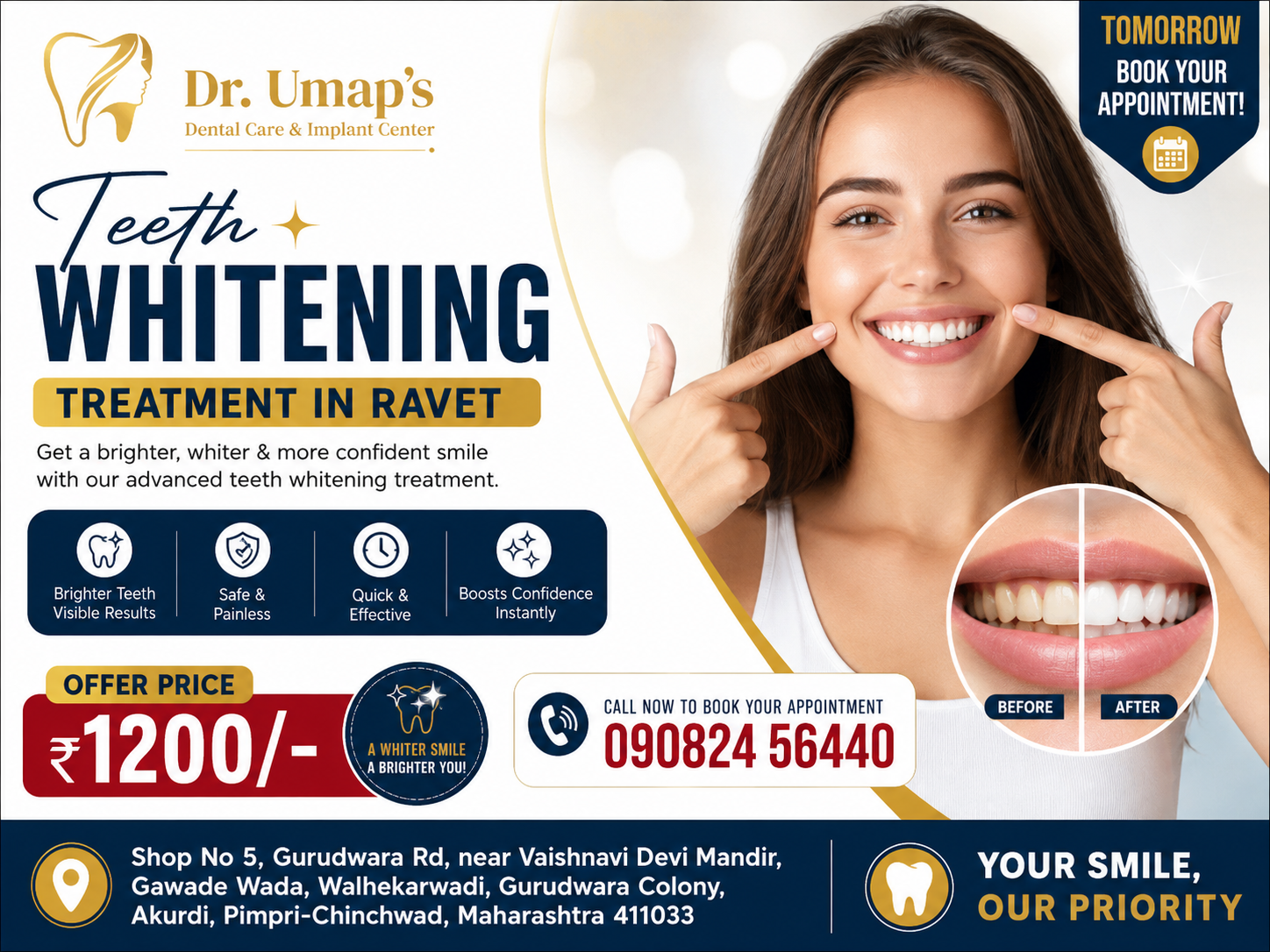 Teeth Whitening Treatment in Ravet Cost Rs 1200/-