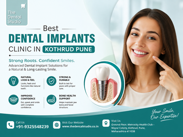 Best Dental Implants Clinic In Kothrud Pune