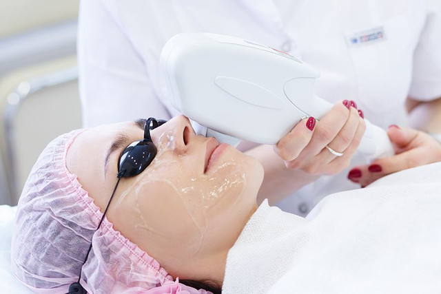 Laser Facial Delhi Complete Guide to Glowing Skin In Myraluxxe.com