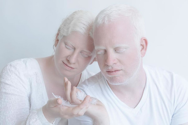 Beauty Of Albino People In Yulia Taits's Photography